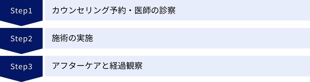 カウンセリング予約・医師の診察、施術の実施、アフターケアと経過観察