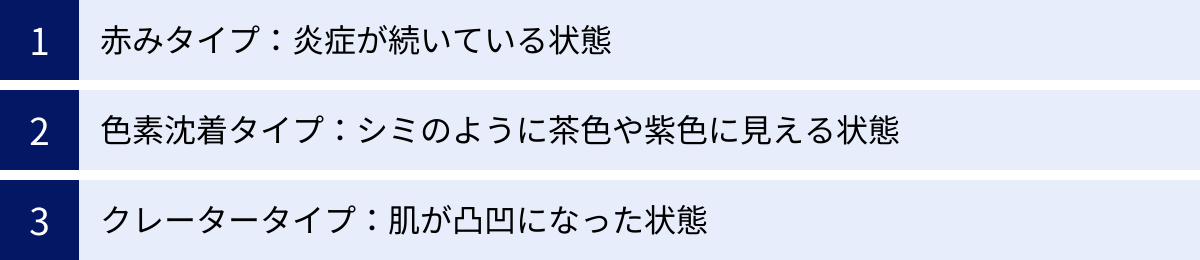 赤みタイプ：炎症が続いている状態、色素沈着タイプ：シミのように茶色や紫色に見える状態、クレータータイプ：肌が凸凹になった状態